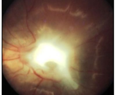 Manzatti-Informaciones-Leucocoria-2