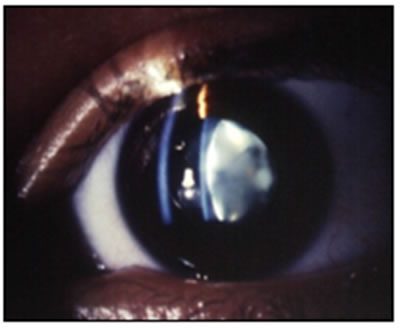 Manzatti-Informaciones-Leucocoria-3